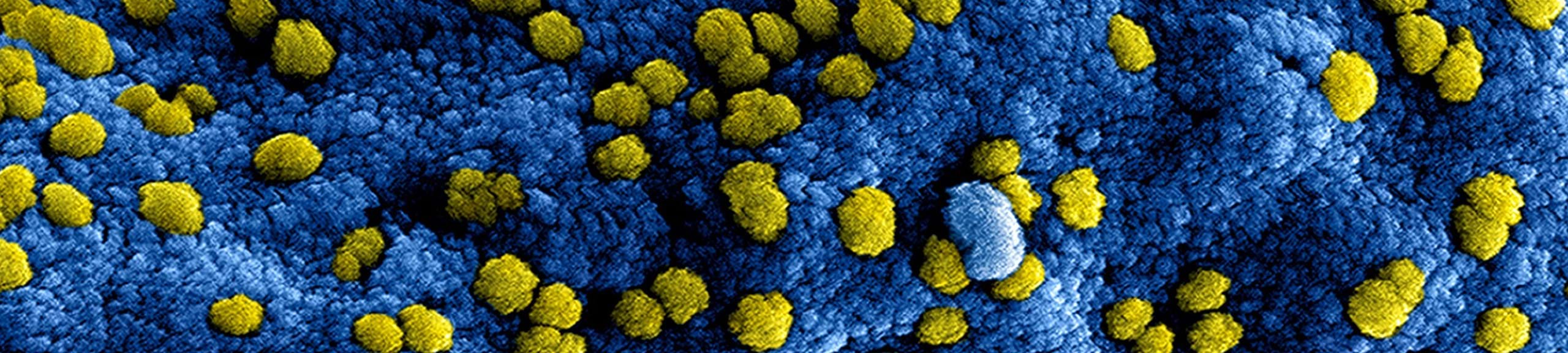 Nieuwe coronamaatregelen